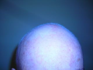 hair