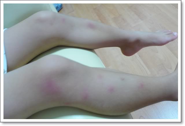 สวนรถไฟ วันอาทิตย์ที่ 31 พฤษภาคม 2552 ติดตามอาการป่วยของลูกครับ