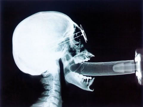 x ray art. Filed in All entries, Art,